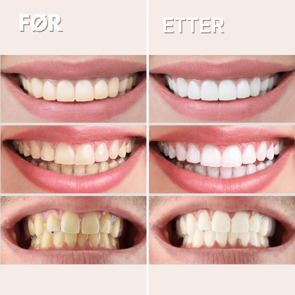 GlorySmile™ V34 Blekende Tannpasta (30 ml) - AVABeauty.no